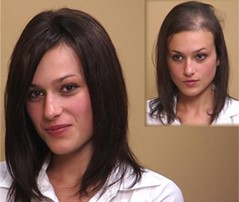 What Causes Female Hair Loss - HCI Orlando